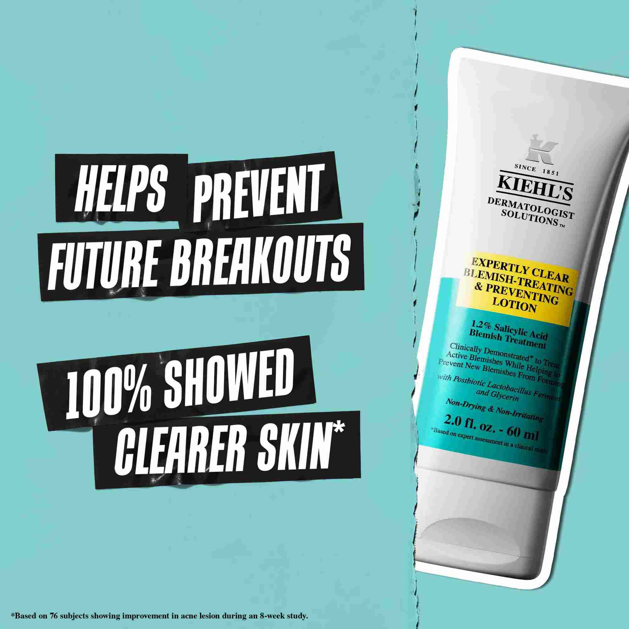Tuba Expertly Clear Blemish-Treating & Preventing Lotion na modrem ozadju z besedilom: »Pomaga preprečevati prihodnje izbruhe« in »100 % je pokazalo čistejšo kožo.«