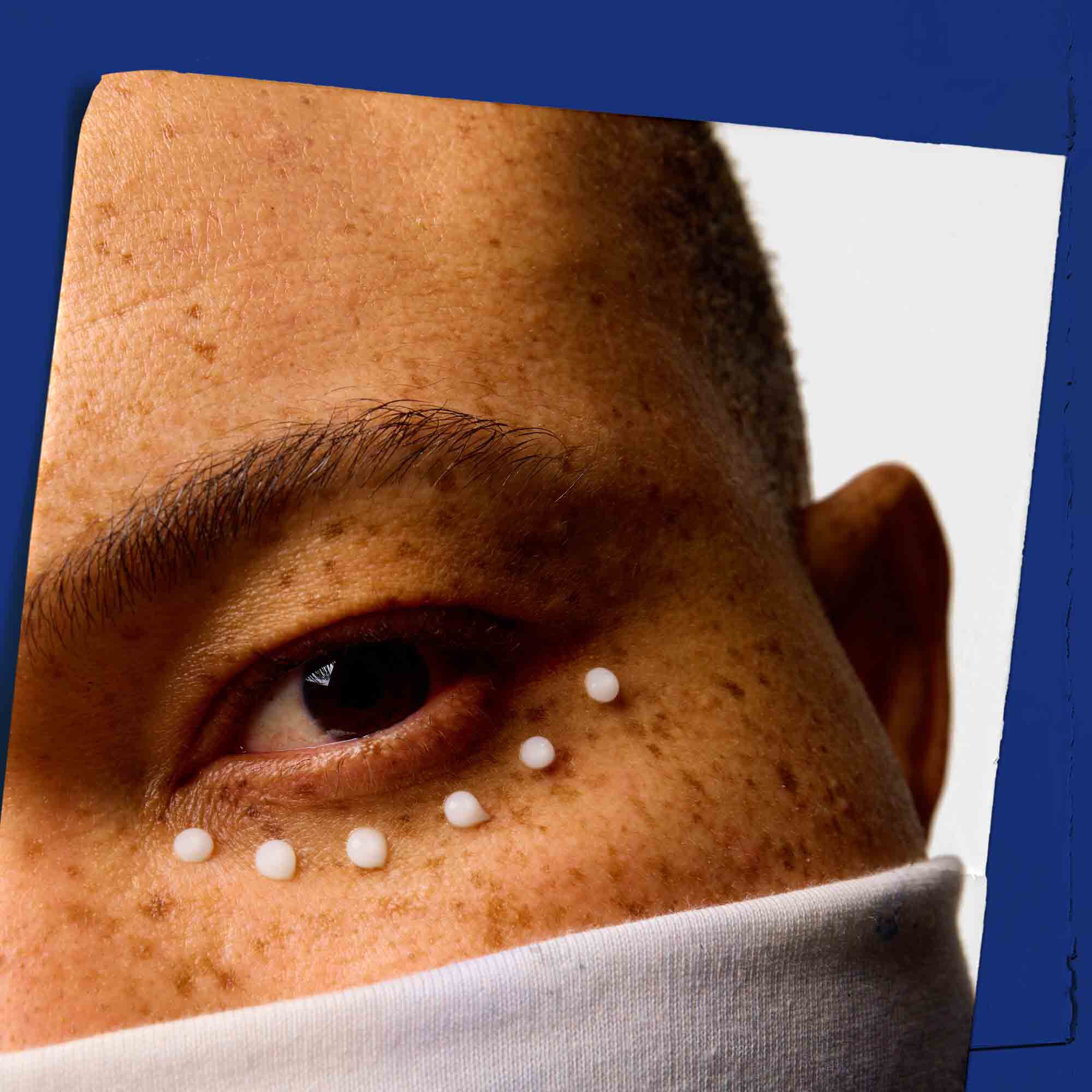 Bližinski posnetek kože okoli oči s pikami Facial Fuel Eye Fuel.