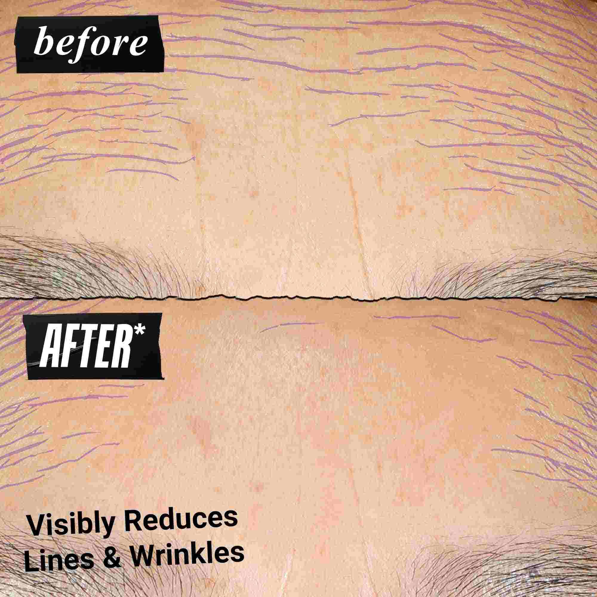 Fotografija pred uporabo in po njej – serum Kiehl's Retinol Skin Renewing Daily Microdose pomaga izboljšati ton in teksturo kože