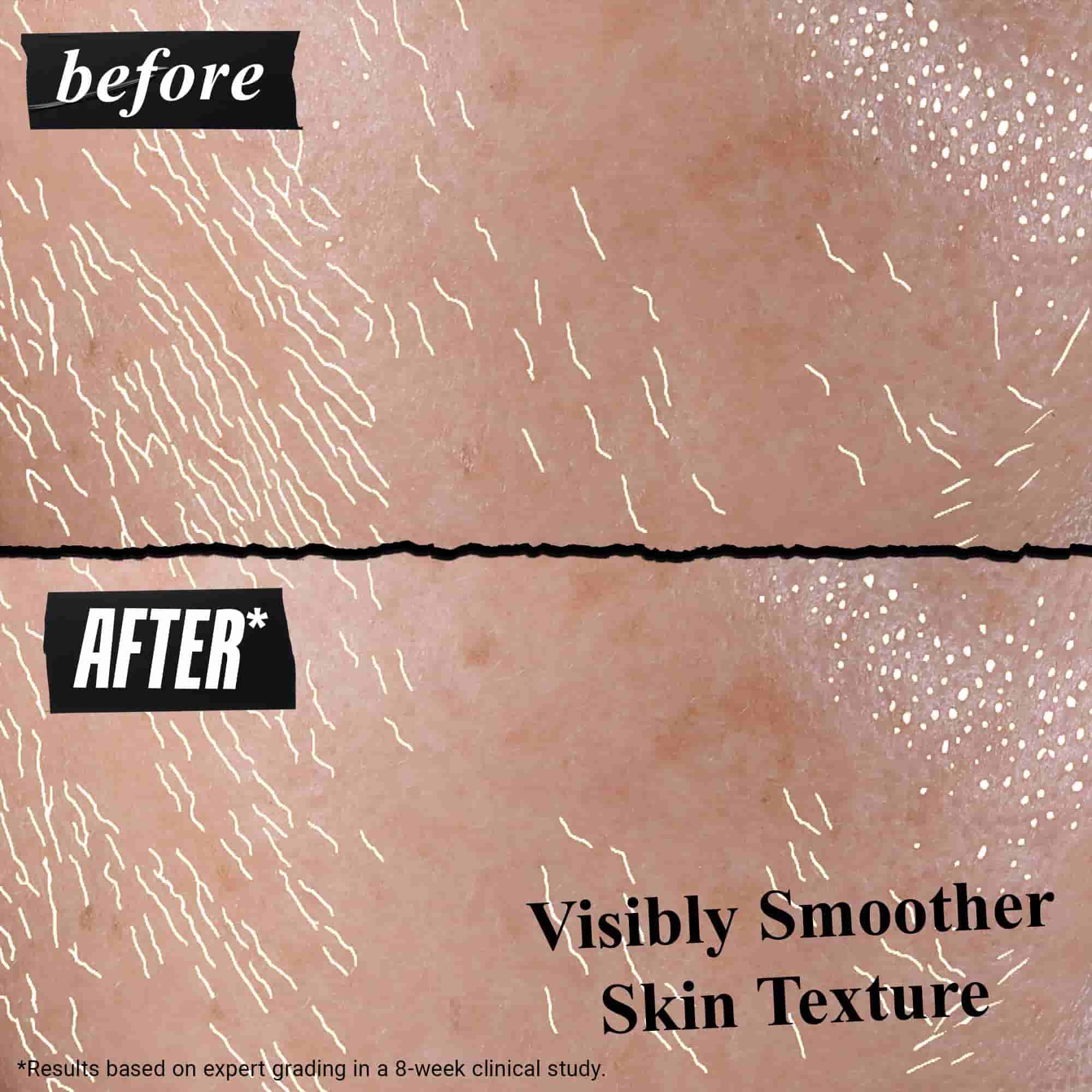 Rezultati na koži pred in po uporabi Better Screen UV Serum