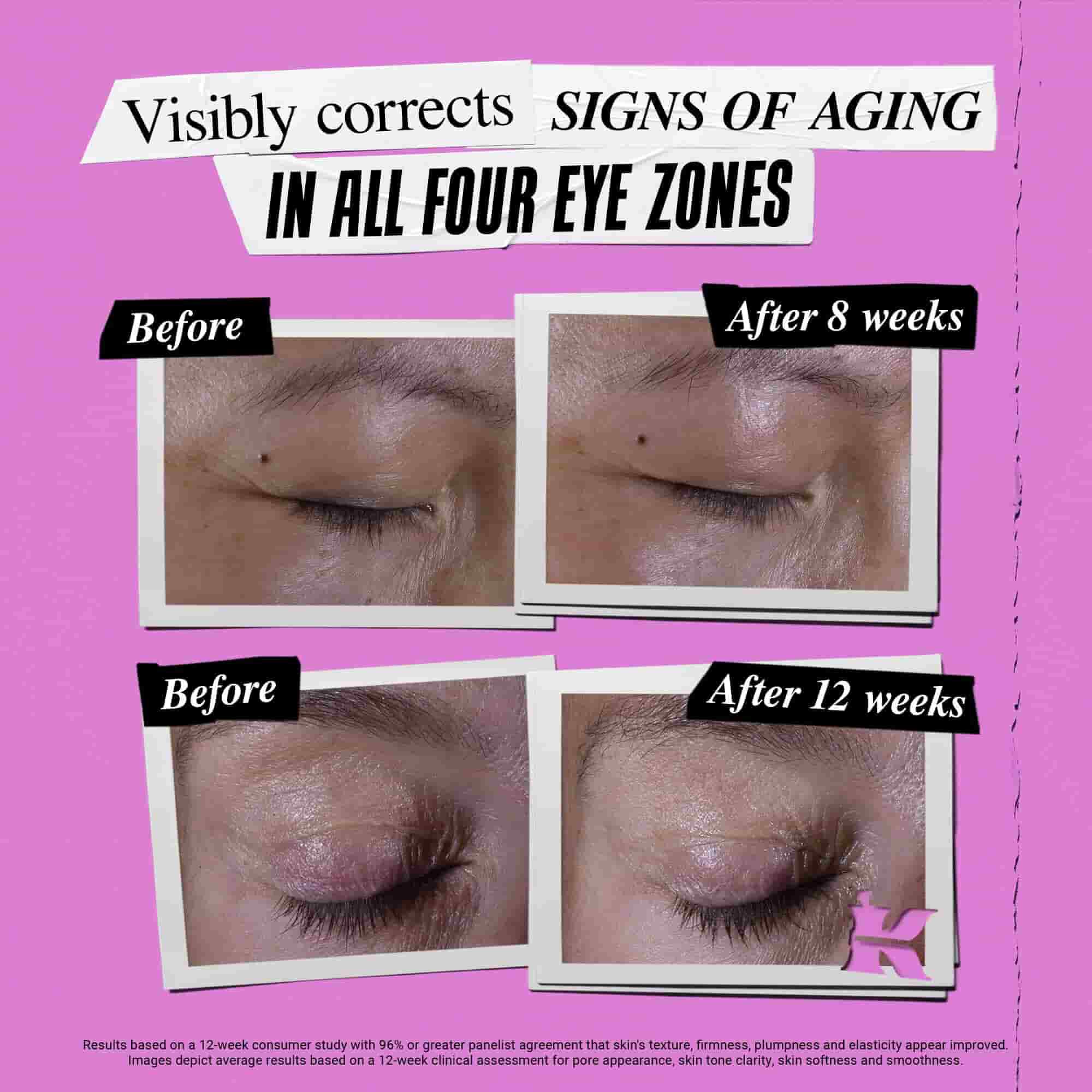 Fotografija pred uporabo in po njej – krema Kiehl's Super Multi-Corrective Eye Zone Treatment korigira znake staranja