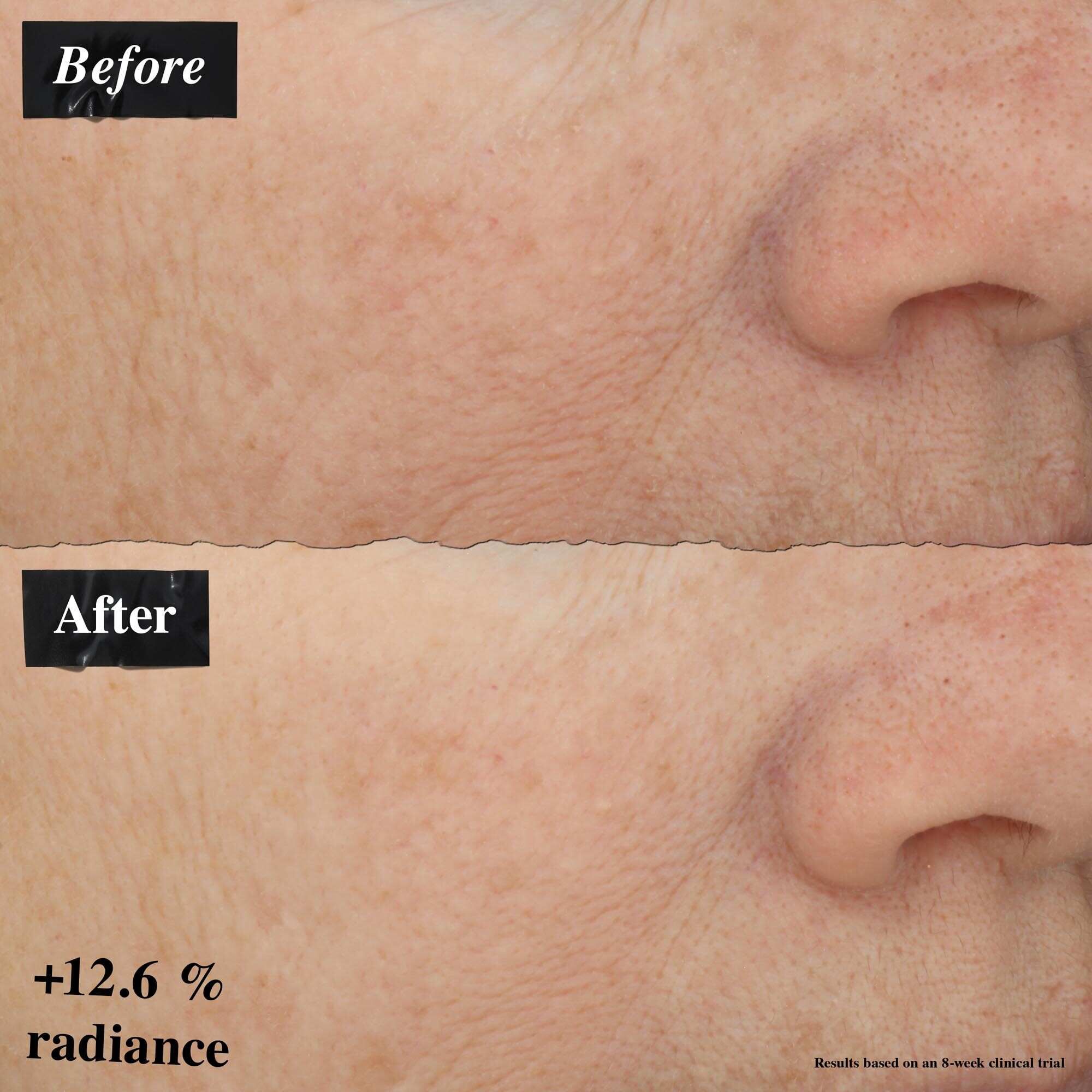 Primerjava slik prej in potem, ki prikazuje izboljšanje rdečice kože po uporabi Powerful-Strength Line-Reducing Concentrate.