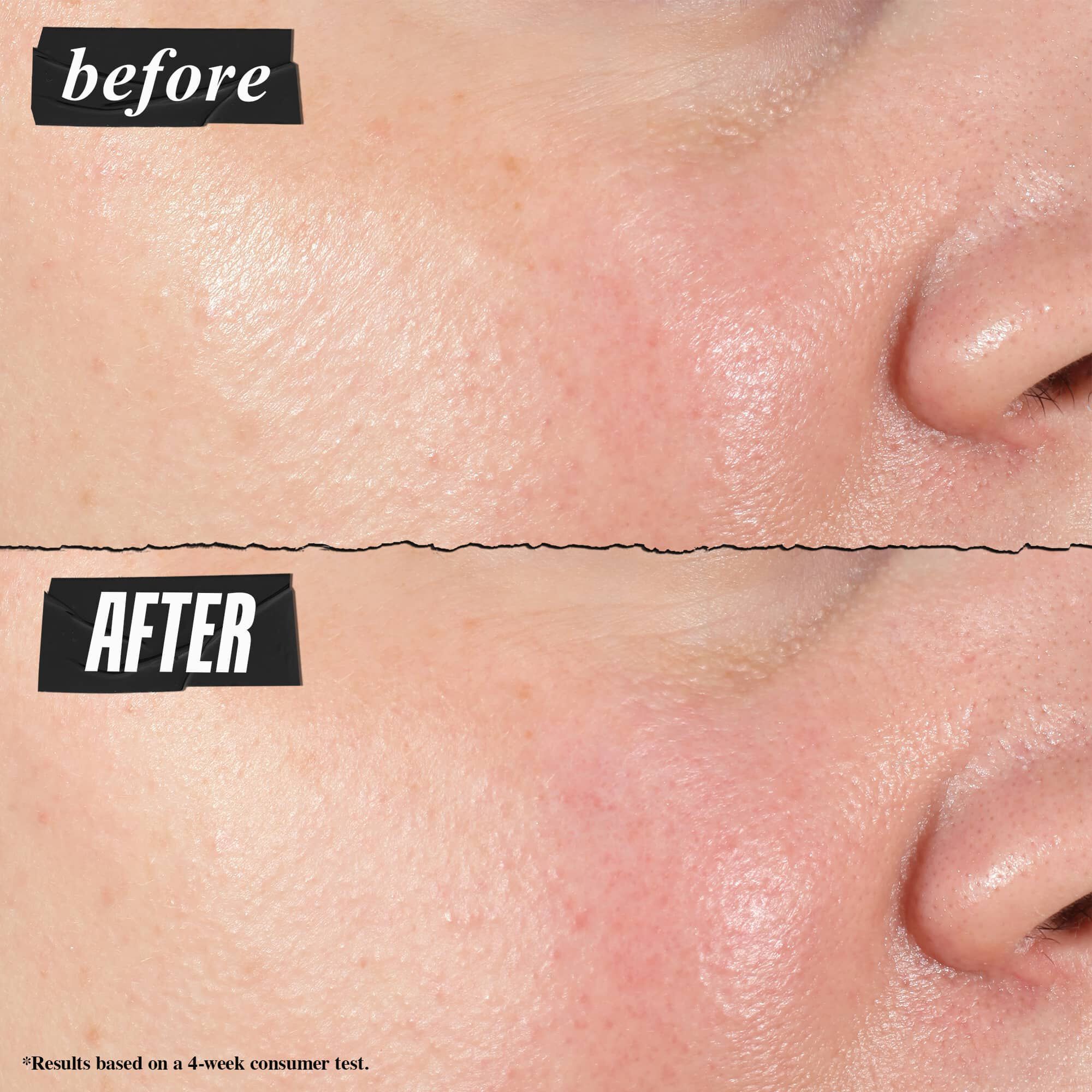 Fotografija pred uporabo in po njej – koncentrat Kiehl's Hydro Plumping Serum Concentrate vidno zmanjša pore