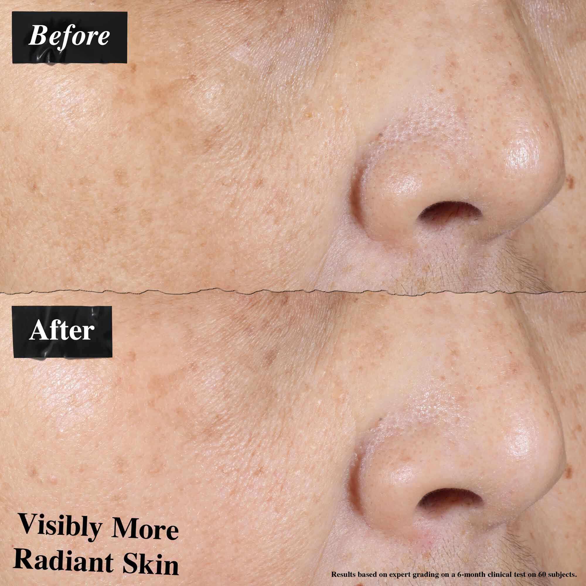 Primerjava prej in potem, ki prikazuje vidno zmanjšano rdečico kože po uporabi Ultra-Light Daily UV Defense.