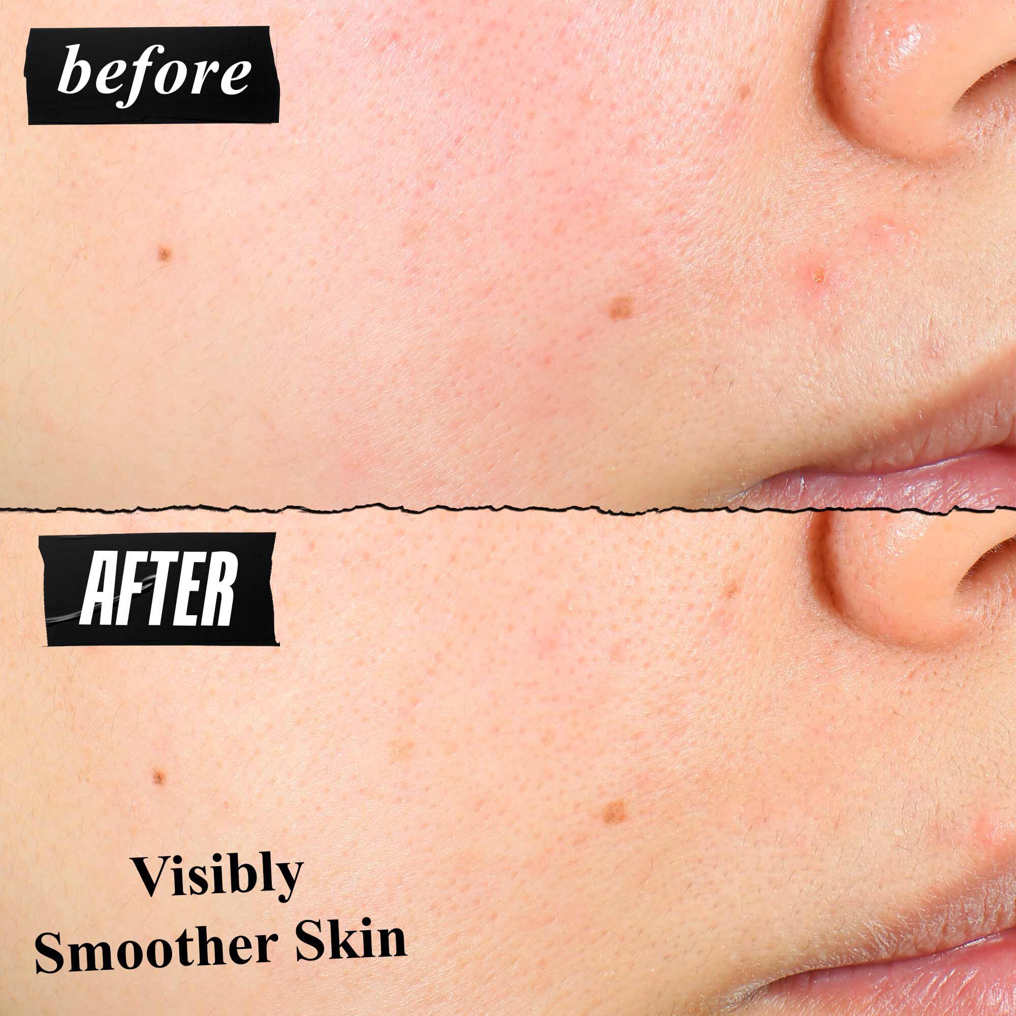 Primerjava teksture kože prej in potem, ki prikazuje vidno bolj gladko kožo po uporabi.