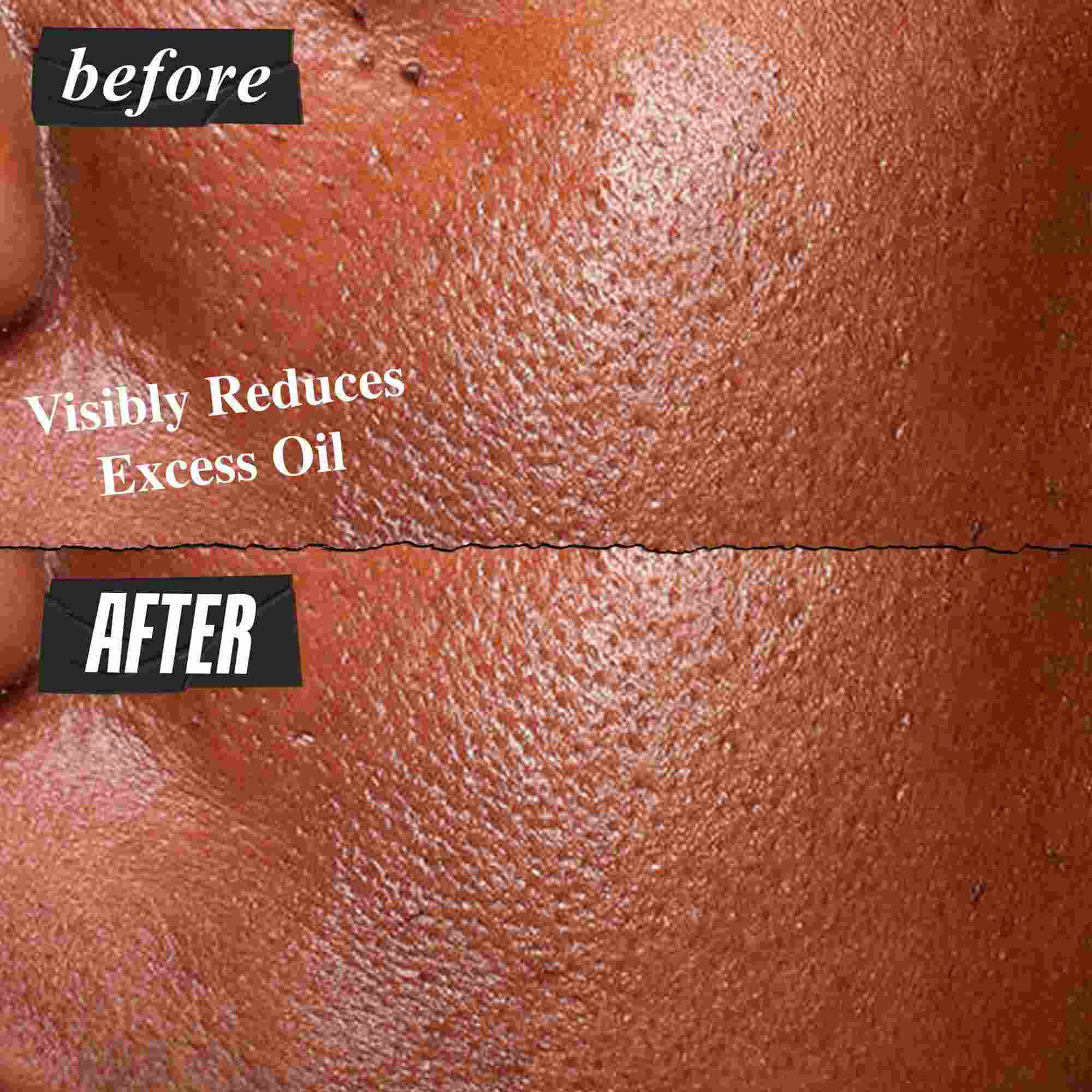 Fotografija pred uporabo in po njej – serum Kiehl's Ultra Pure High-Potency Serum vidno zmanjša odvečno maščobo
