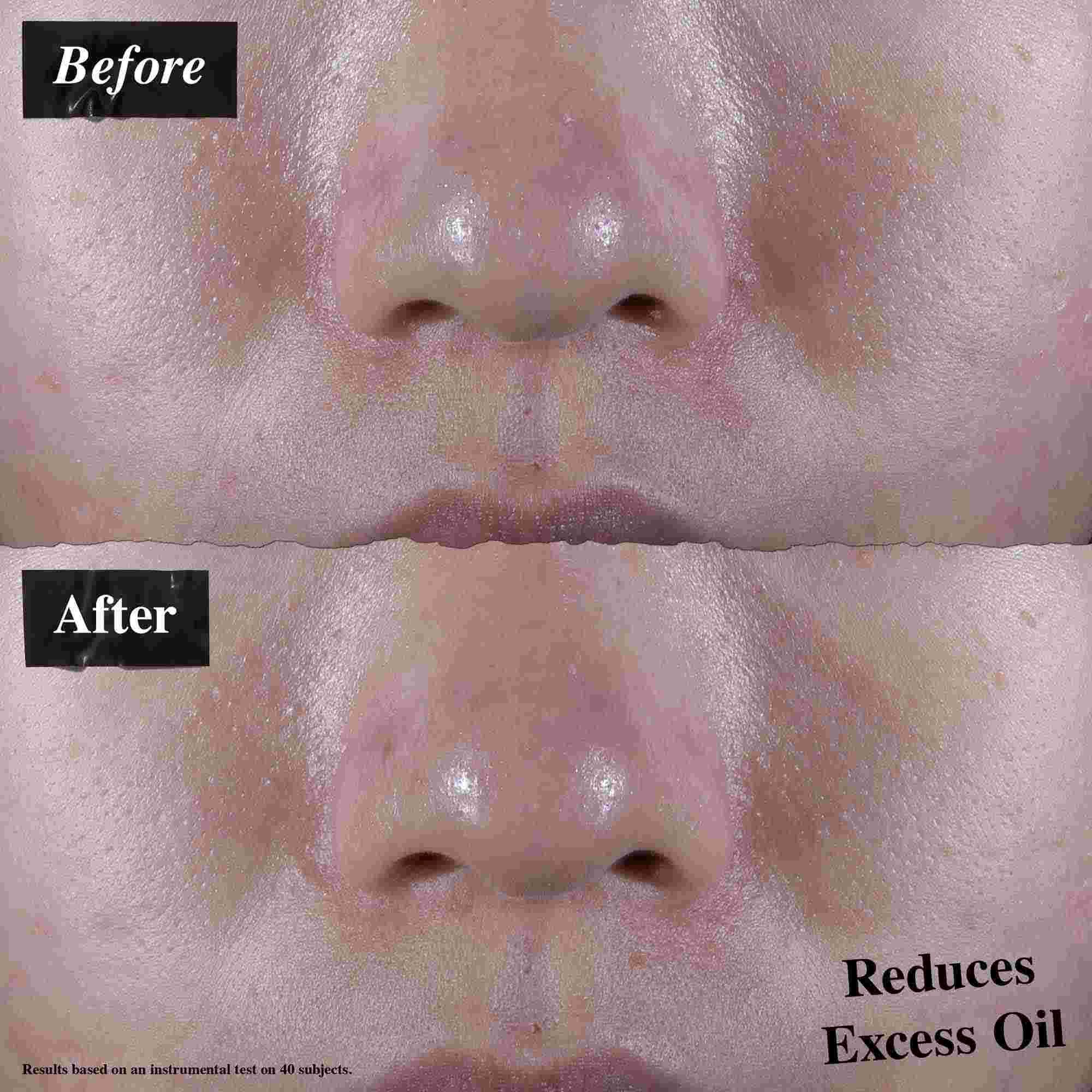 Primerjava prej in potem, ki prikazuje zmanjšano odvečno maščobo po uporabi Ultra Facial Oil-Free Gel Cream.