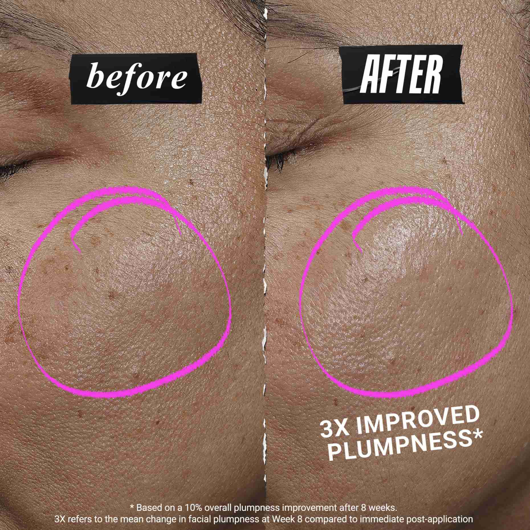 1cc CollaShot Plump serum, serum za obraz z rekombinantnim kolagenom za bolj čvrst in poln videz kože