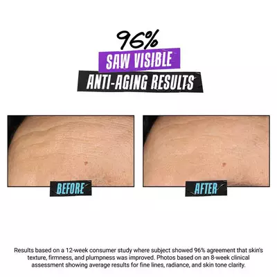 Alt text: "Before and after photos demonstrating visible anti-aging results, with 96% of participants in a study noticing improvements in skin texture, firmness, and plumpness over 12 weeks."